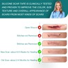 Silicone Scar Sheets (1.6"x 158" Roll-4M), Silicone Scar Tape for