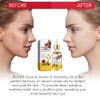 plomala Aceite facial con vitamina E, aceite de rosa con