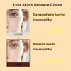 PDRN Salmon DNA Cream for Skin Barrier Support and Improved