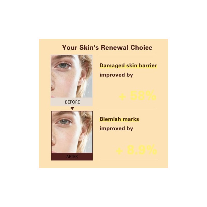 PDRN Salmon DNA Cream for Skin Barrier Support and Improved