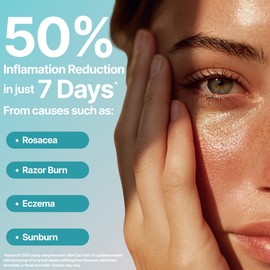 Noredol Skin Care Gel - Redness Relief Moisturizer for Dry Skin - Rosacea Treatment for Face - Soothes Prone Skin and Irritation - Fragrance Free 2 oz