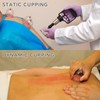 Cupping Therapy Set 32 Massage Therapy Cups Cupping Kit for