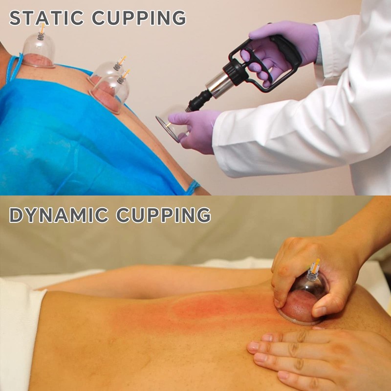 Cupping Therapy Set 32 Massage Therapy Cups Cupping Kit for