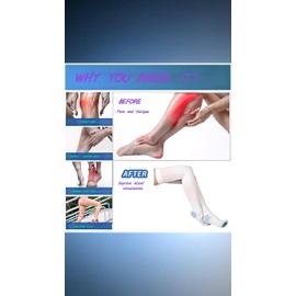 Thigh-High Compression Stockings 15-20 mmHg - Anti-Embolism TED Hose with Inspection Toe Hole for Men & Women