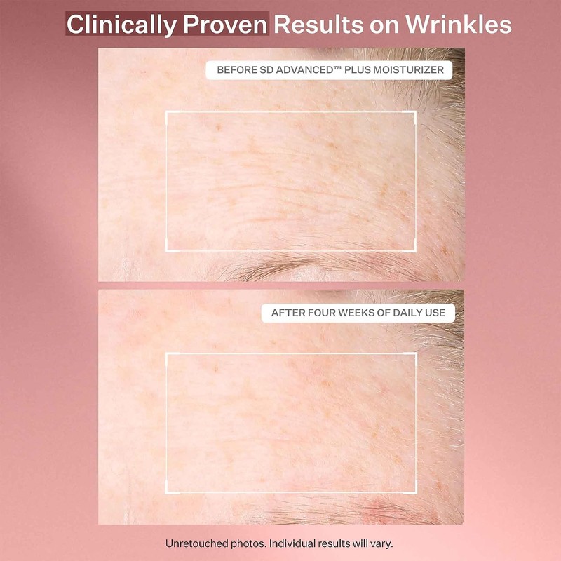StriVectin SD Advanced PLUS Intensive Humectante ataca la pérdida de