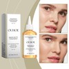 ouhoe Salicylic acid anti-acne essence is used to shrink pores,