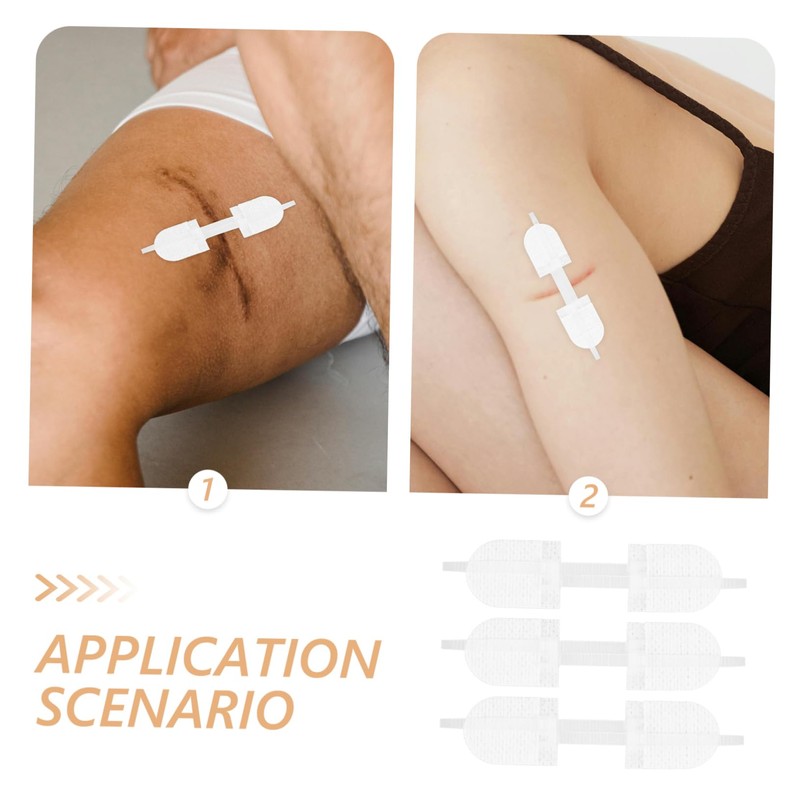 TOVINANNA 5sets Emergency Strips Self Wrap Tape Scar Reduction Bandage