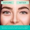 Patchology Restoring Night Eye Gels - Under Eye Patches For