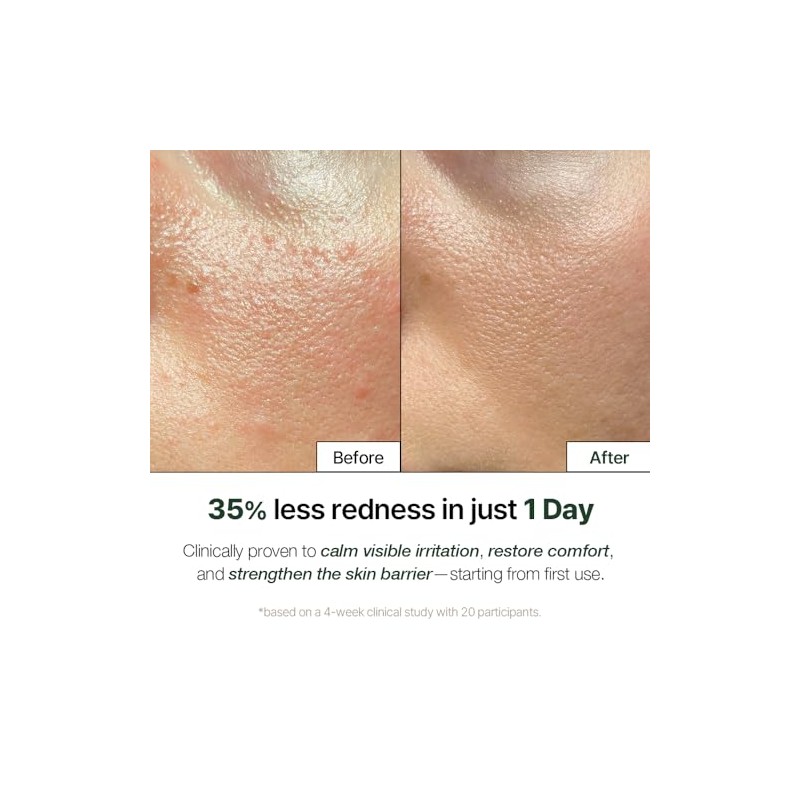 Natural Derma Cica Cream - Soothing Gel Face Moisturizer