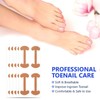 HOBKEY 140 Pieces Ingrown Toenail Stickers Correction Patches for Toenails