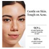Neutro Oil-free Acne Face Wash - Facial Cleanser With