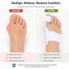 Adjustable Bunion Corrector for Big Toe Alignment – Comfortable Toe