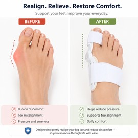 Adjustable Bunion Corrector for Big Toe Alignment – Comfortable Toe Separator for Daily Foot Care at Home