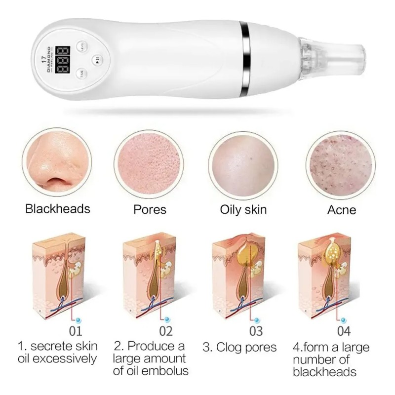 Microdermoabrasion Peeling 3 Puntas Diamante C/caja