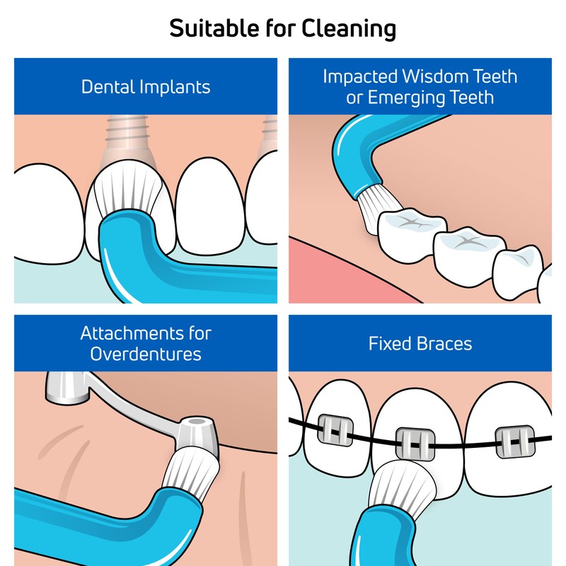 TEPE Compact Tuft Toothbrush, Tufted Brush End Orthodontic Toothbrush for