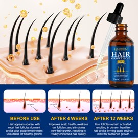 Haarwachstum LöSung, Haarwuchs-öL, EnthäLt Biotin Und RizinusöL, Aktiviert Die Haarfollikel, FöRdert Gesundes Haarwachstum, NäHrt DüNner Werdendes Haar, Hilft Haarausfall Zu Reduzieren 60ml