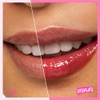 SKINTIFIC Serum Labial con Polipéptidos y Escualano – Gloss Hidratante