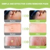 Corn Plasters, Stubborn Corns Removal Sole