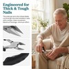 Solvio Professional Ingrown Toenail Clippers for Thick Nails - Heavy