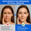 Triangle Wrinkle Patches – Anti Wrinkle Facial Patches for Elevens,
