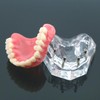 Dental Typodont Implant Teeth Model Clear Overdenture 4 Implants Maxillary