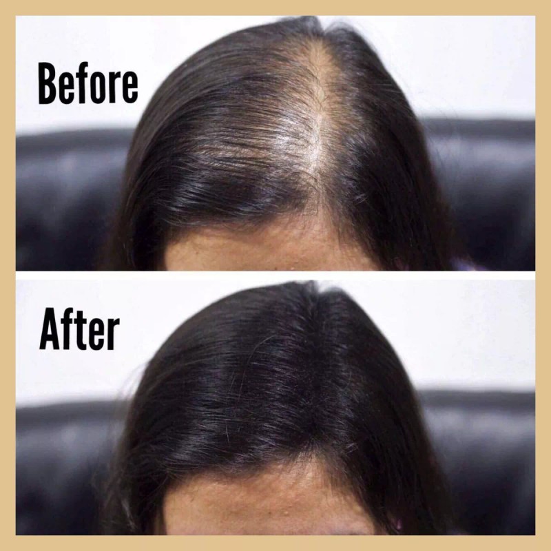 Universo en Linea Paquete Caboki Fibras Naturales Sustituto 2 Pzas