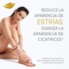Dove Sérum Corporal Concentrado Para Estrías, Cicatrices y Manchas, 100