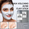 Mascarilla Mask Stick Anti Acne Limpieza Profunda Acneica