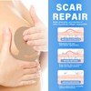Silicone Scar Sheets,Reusable Silicone Scar Tape Strips - Reusable Strips