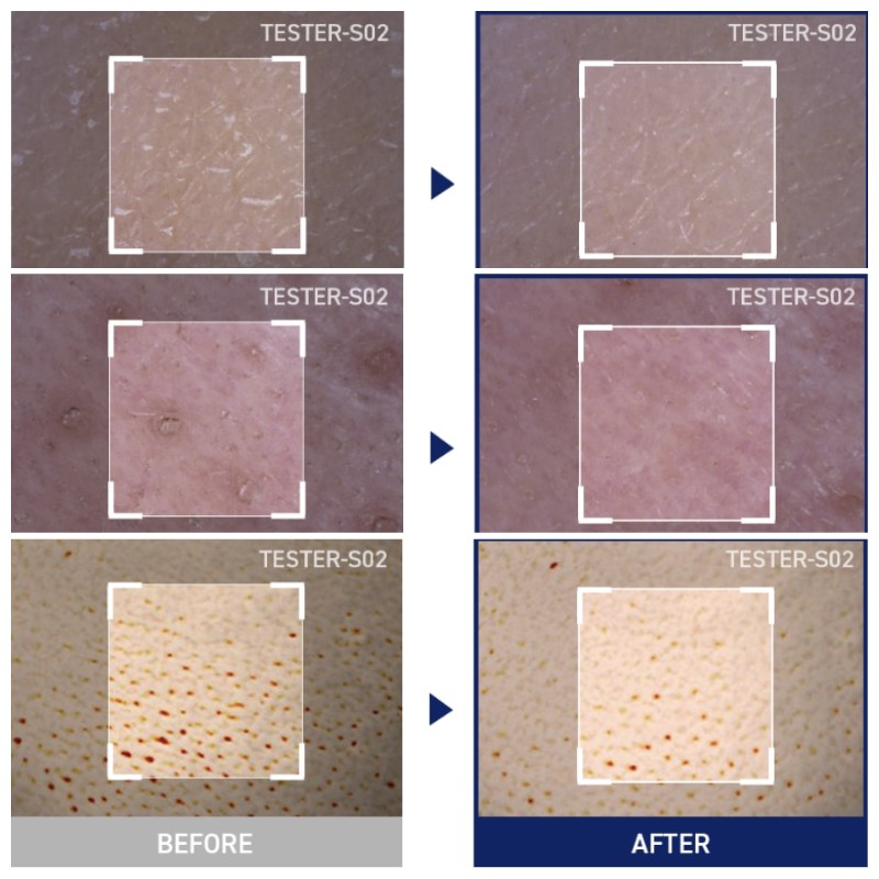 MEDIHEAL Square Toner Pads 200ea, Type:PDRN Lifting Pad