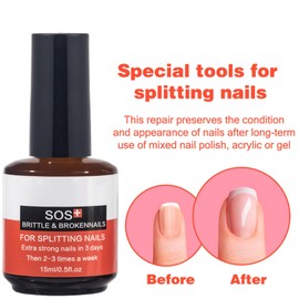 Broken & Brittle Nail Treatment - Multi-purpose Nail Strengthener - Strengthening Hardening Conditioner - Extreme Strength Nail Serum - Quick Help for Split, Brittle and damaged Nails, 15ML