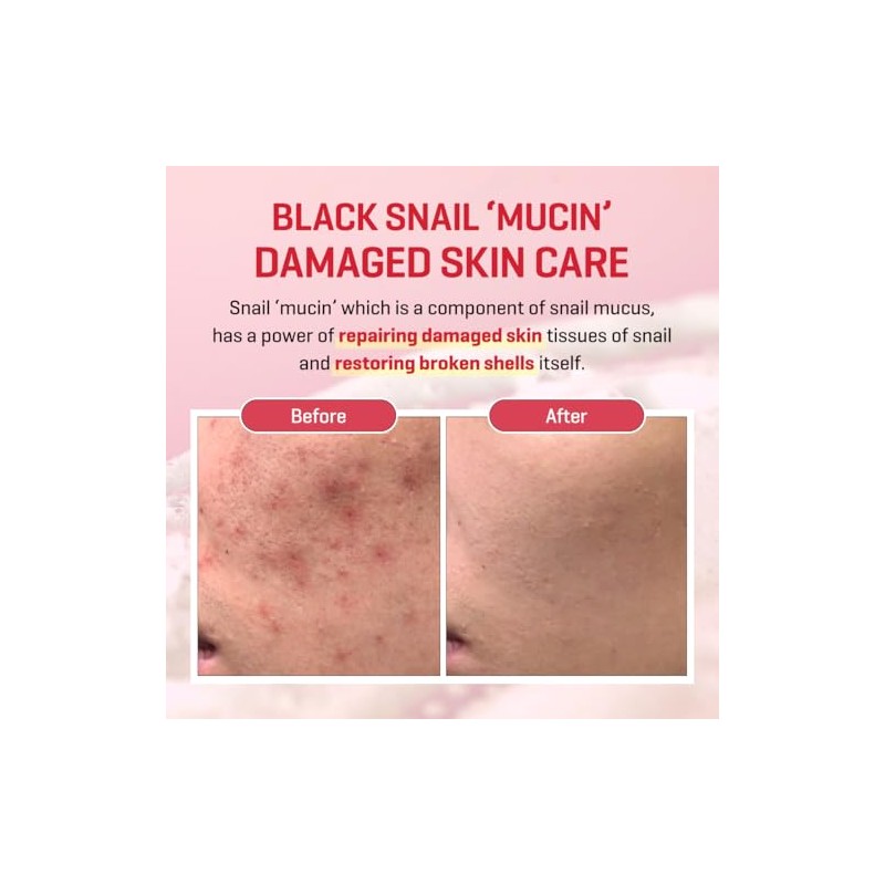 SOME BY MI - Snail Truecica Miracle Repair Low pH