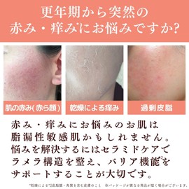 Dr. Re9 Creture Jelly Lotion EX Hypoallergenic Sensitive Ceramide Lotion Strengthens Weakened Skin (Redness, Red Face, Seborrheic Sensitive Skin, Rough Skin, Muscular Skin, Drying, Sebum Sensitive,