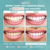 Teeth Whitening Strips - 42PCs White Strips for Teeth Whitening