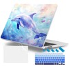 Lepeoac Case for MacBook Air 15 Inch 2025 2024 2023