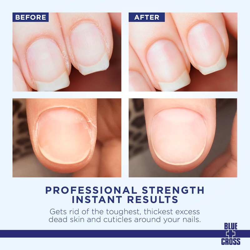 Blossom Blossom + Blue Cross Hydrating, Moisturizing, Strenthening Cuticle Oil