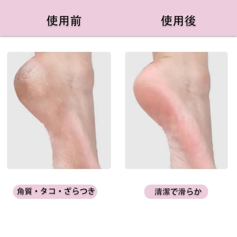 YUYAYOON ステンレス角質取りナイフ 全長 13cm 1 個入り かかと足裏角質除去フットスクレーパー