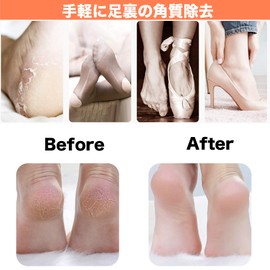 Heel Sharpener, Exfoliating Tool, Foot File, Nano Glass, Fully Washable, For Dry and Wet Feet