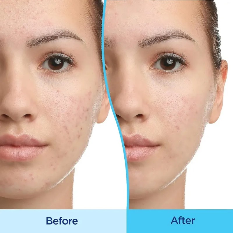 HD Cosmetic Efficiency Sérum Facial Antimanchas Melan-TXA 30ml