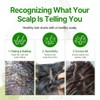 SOME BY MI Cica Peptide Anti Hair Loss Scalp Shampoo,