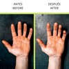 Velites Stone Hand Care System and callus remover for Athletes