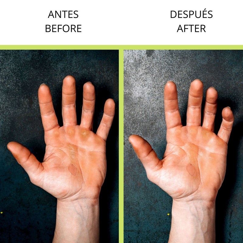 Velites Stone Hand Care System and callus remover for Athletes