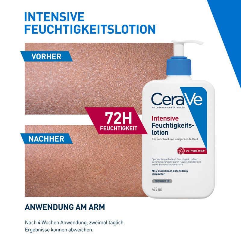 CeraVe Intensive Moisturising Lotion, Intensive Moisturising and Itche-Reducing, For Very