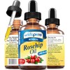Aceite De Rosa Mosqueta Con Vitaminas A, C Y E