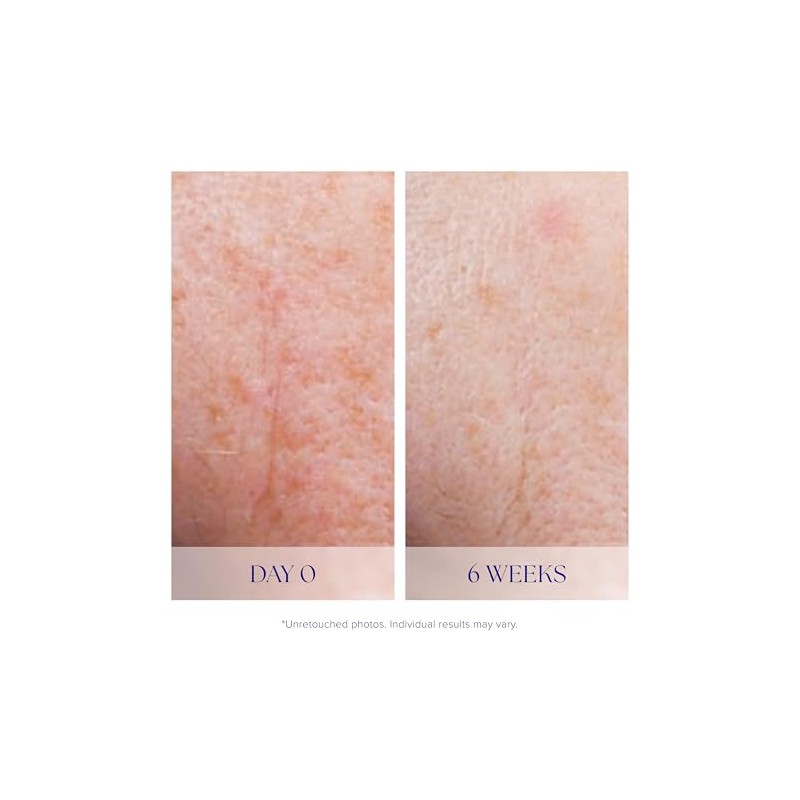iS CLINICAL Active Serum, Helps visibly even skin tone, Excellent