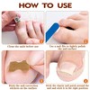 HOBKEY 140 Pieces Ingrown Toenail Stickers Correction Patches for Toenails
