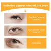 Eelhoe - Parches Para Ojos Antiarrugas 20 Pzas Hidratantes