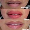 Herramienta de cepillo de labios, cepillo exfoliante de silicona de