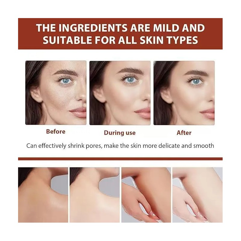 Iu Crema Hidratante Nida Formula Juvenil Ultimate* Nida