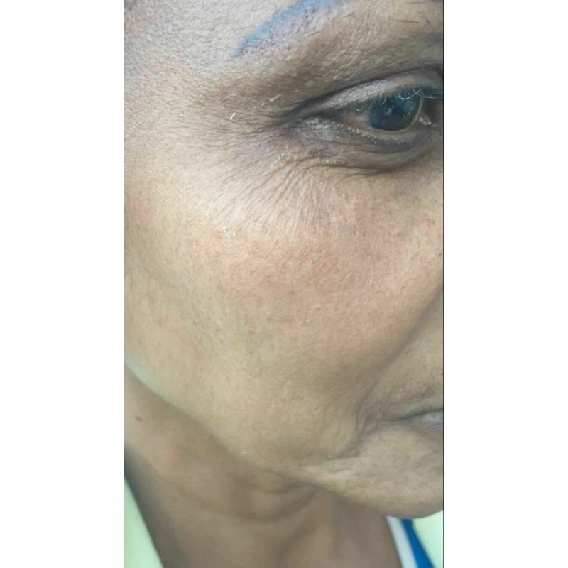 Crema aclaradora White Fade Super Skin, Para Piel Triguena O